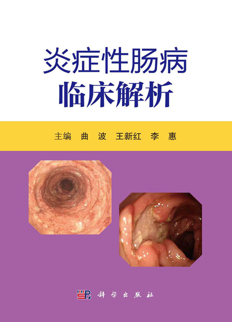 放大镜特效